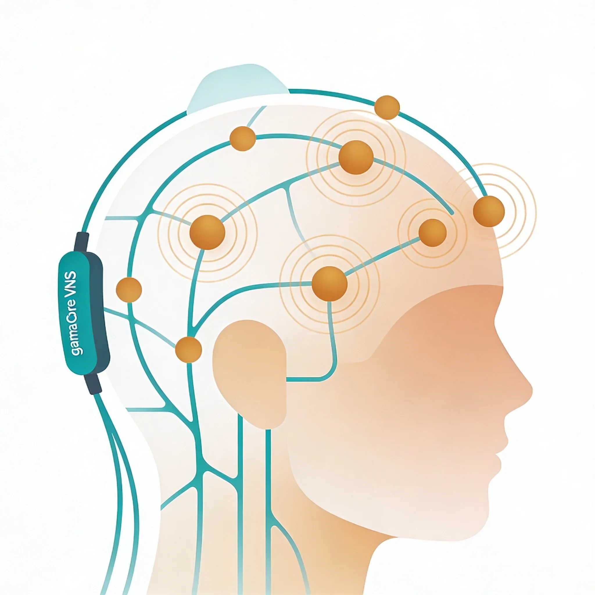 Hero image for Can This FDA-Cleared Device Stop Your Headaches Without Surgery?